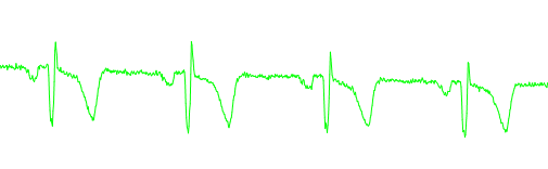 Upp och ner, men det gör väl inte så mycket. 